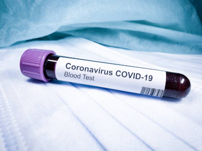 Worin liegen die Unterschiede zwischen Corona und Grippe?
